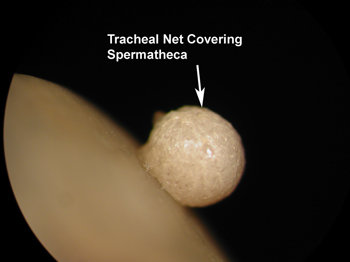Spermatheca-6.jpg