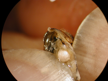 Spermatheca-4.jpg