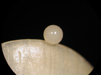 Spermatheca-5.jpg