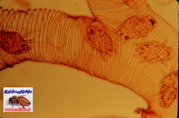 تصاوير كنه اكارين با نام علميacarapis woodi. Acarine mite
