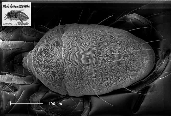 تصاوير كنه اكارين با نام علميacarapis woodi. Acarine mite