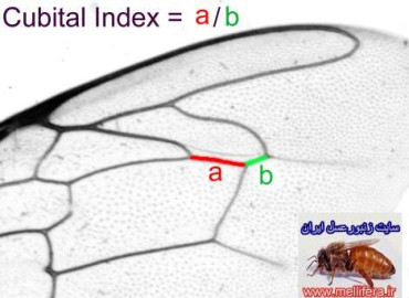 بالها و زاويه ايندكس كوبيتال(cubital index)